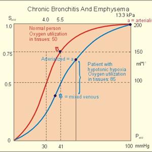  Acute Bronchitis Symptoms: Cough, A Fever, Chest Pain, & More