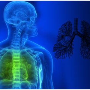  Bronchitis Signs 