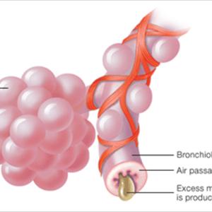 Natural Remedies For Bronchial Problems 