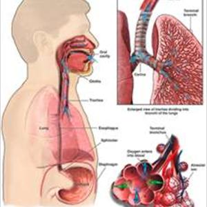 Pneumonia Cure - Chronic Cough Causes, Symptoms And Also Treatment