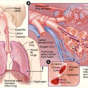 Wheezing And Pnenomia 