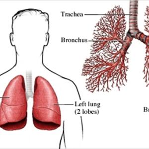 Bronovil Bronchitis Remedy - Cold Flu Virus Treatment, Medicines, And Herbs