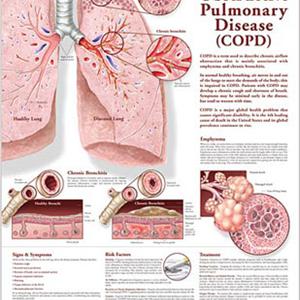 Preventing Bronchitis - Giving Up Smoking - And The Radioactive Components Inside Cigarettes!